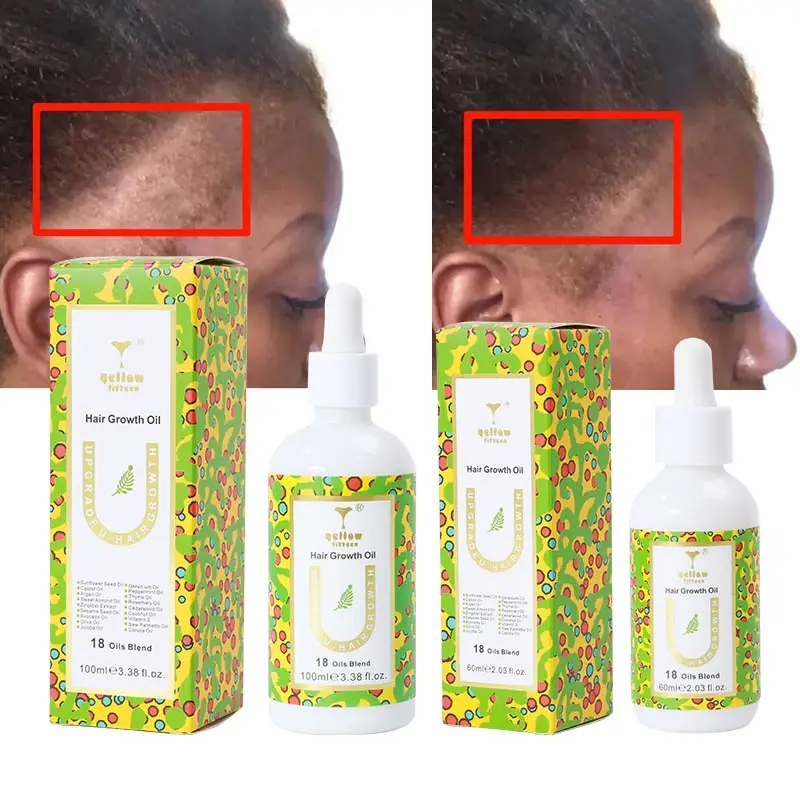 Private Label Natural Organic Wholesale Scalp Elixirs Care Loss Treatment Rosemary Hair Growth Oil Serum 100ml for Hair