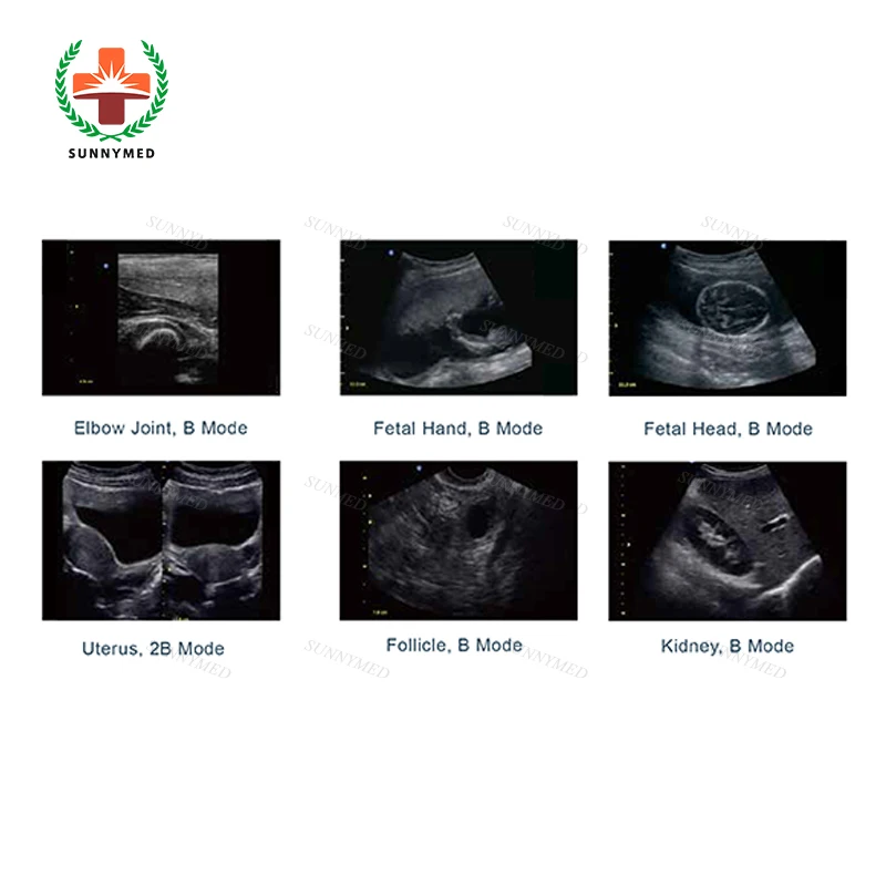  Chison medical Eco1 Eco3 advanced BW портативная ультразвуковая машина с функцией