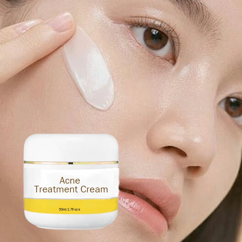 Acne treatment cream Retinol Correction Beauty Care Products Day & Night Sun Protection Moisturizing 2 In 1 Face Cream