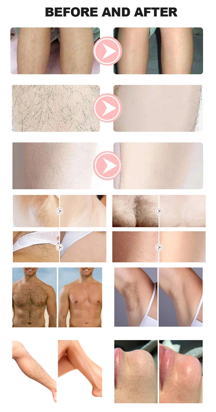 Portable 2-in-1 Pico Laser Tattoo Remover Picosecond Machine Diode Laser Hair Removal All Skin Rejuvenation Whitening