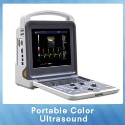 Portable-Color-Ultrasound.jpg