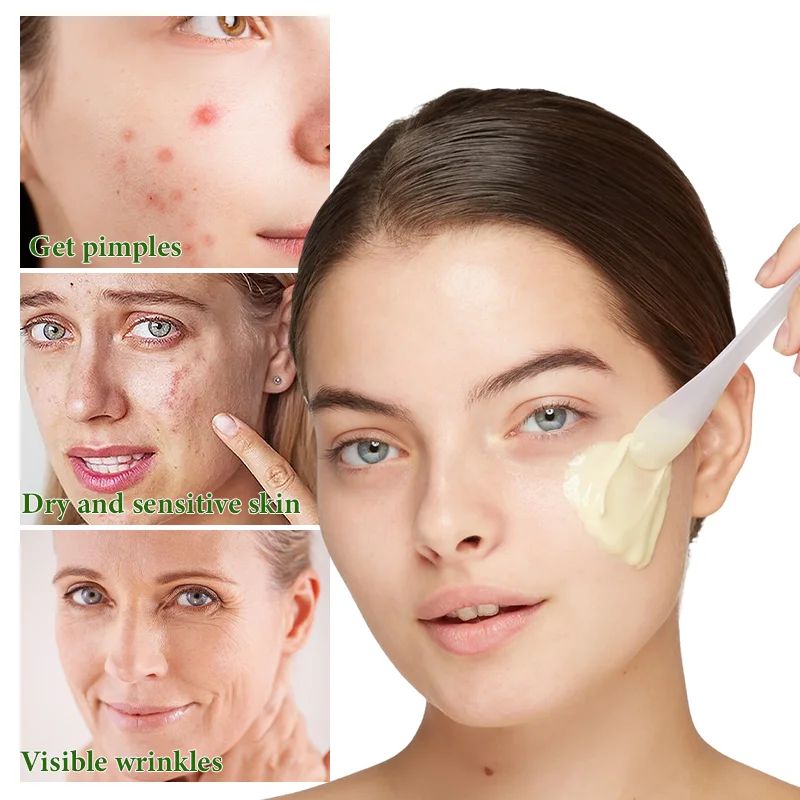 Bio Microneedling Therapy Acne Removal Algae Peeling Skin Tightening Natural Algae Peel Off  Powder