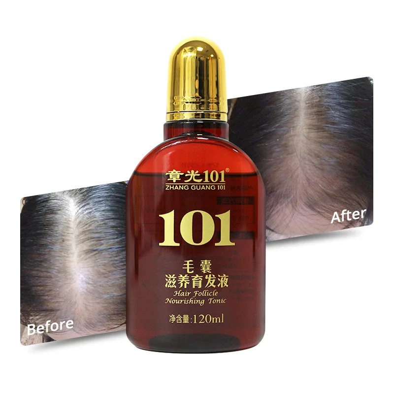 Private Label 100ml-120ml Hair Growth Serum Pure Chinese Herbs Ginger Infused Follicle Nourishing Oil Home Use Bottle Package