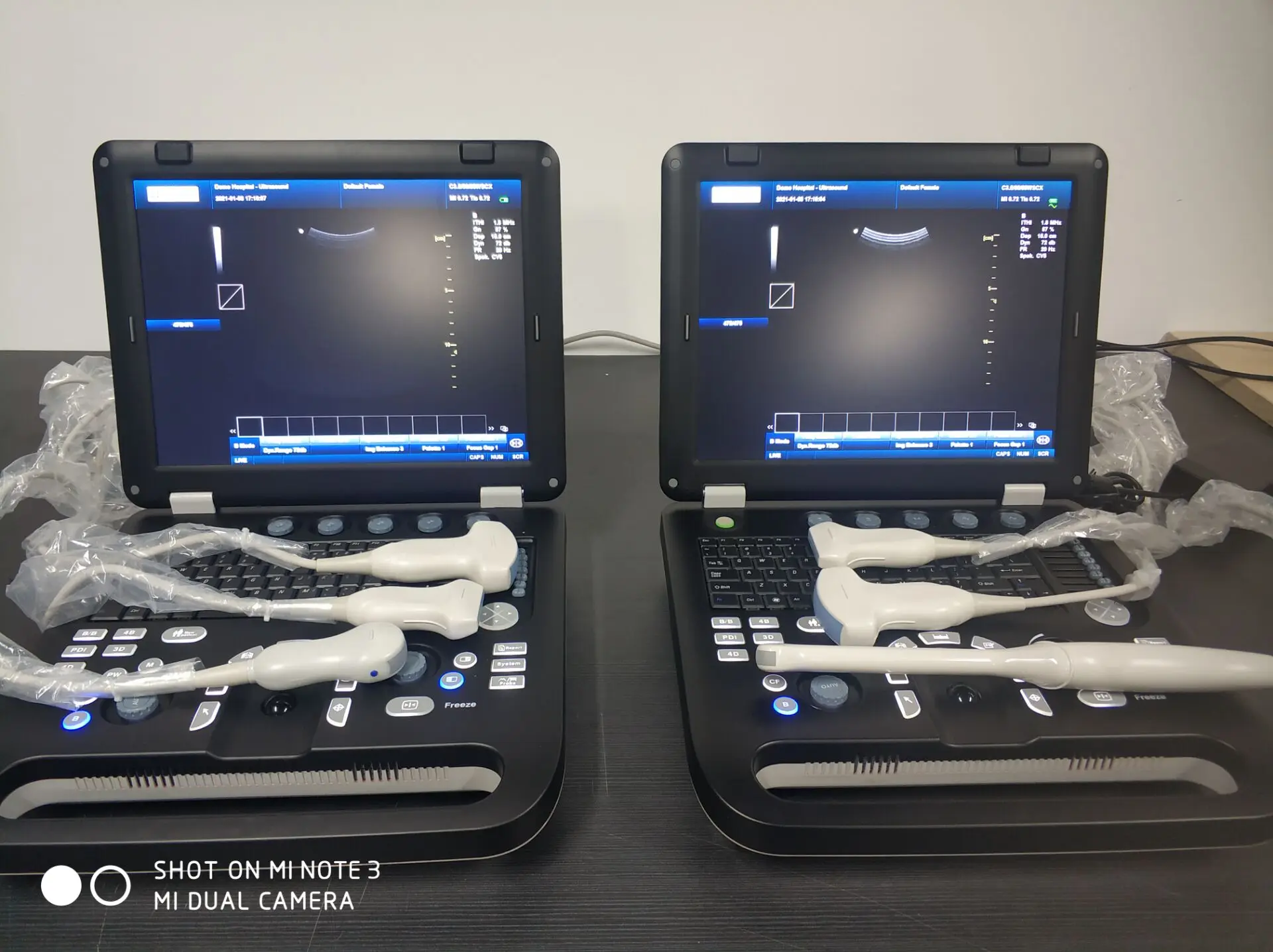 2 set software human and animal use Laptop Ultrasound Scanner Machine with probe