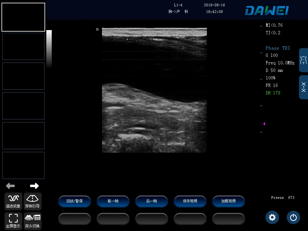 Pc Platform Full Digital Veterinary Black And White Ultrasound Diagnostic System