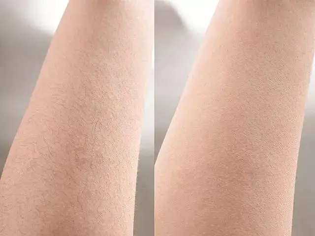 2022 ice big power laser hair removal  808nm 755nm 1064nm diode laser hair permernent hair removal machine