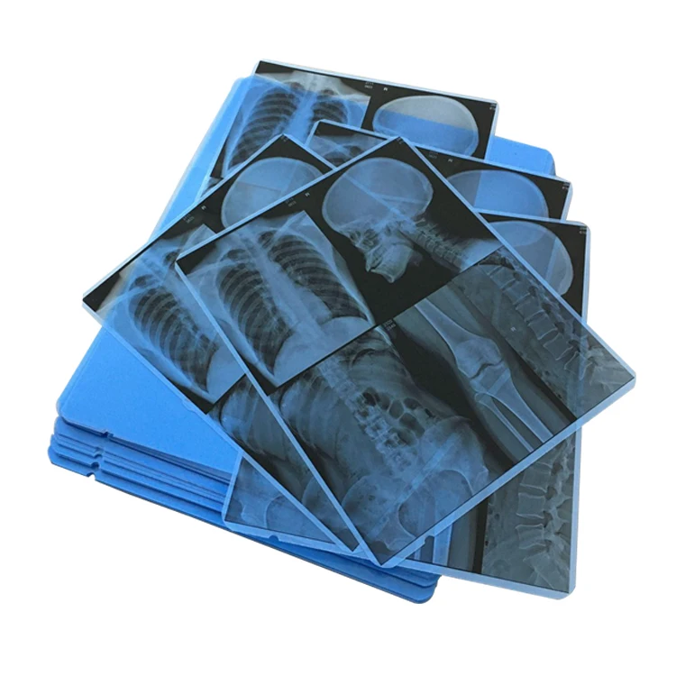 Waterproof PET Base Material Medical 210um Blue Inkjet XRay Film Manufacture