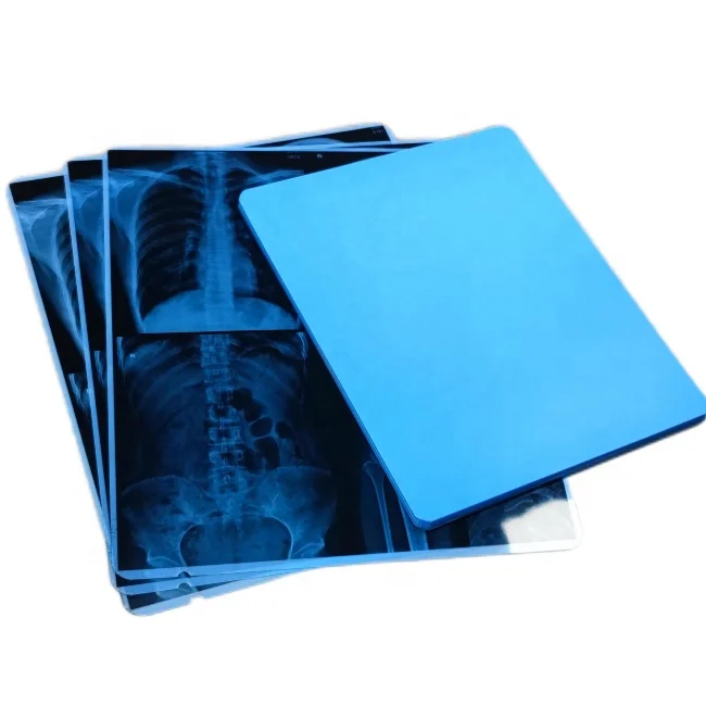 AGFA DT 2B Medical Dry Imaging Film Medical X-ray Film For AGFA Thermal Printer AGFA 5302