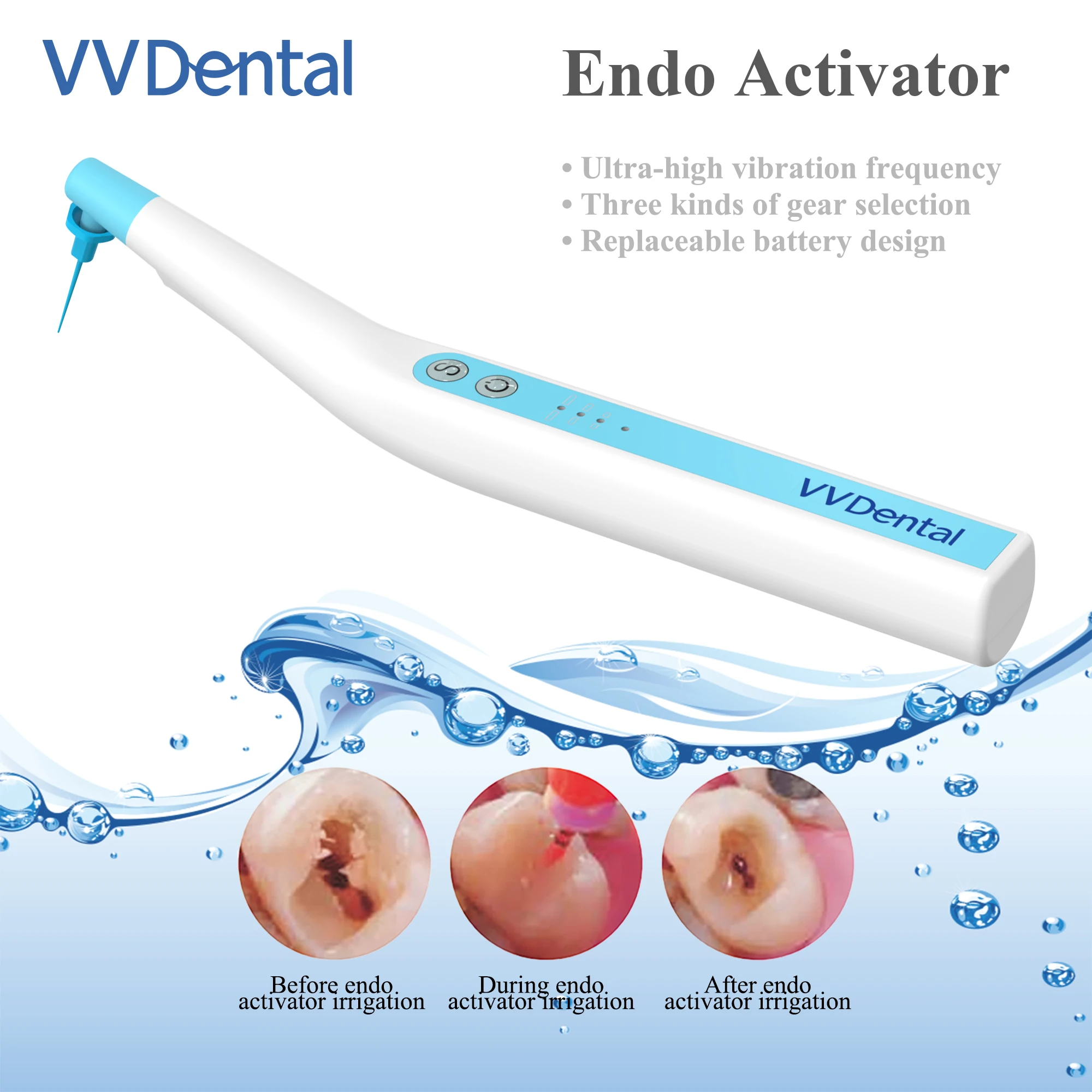 Dental Equipment Ultrasonic Activator Dental Led Cordless Ultrasonic Activator Endodontic Sonic Irrigator Endo Treatment