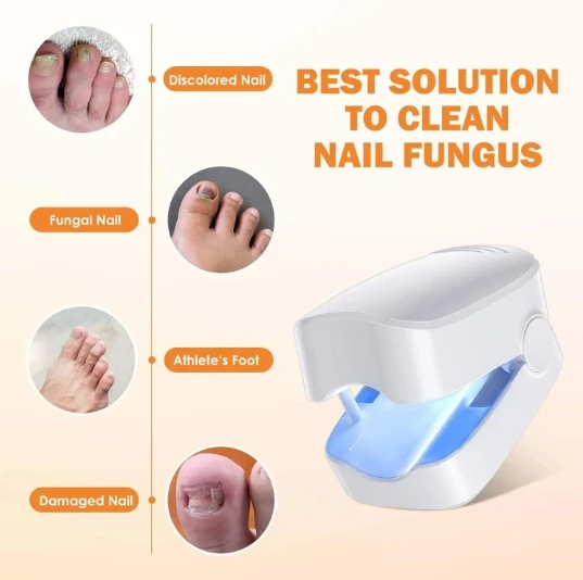 Home laser fingernail and toenail nail fungus cleaning laserdevice treatment machine for onychomycosis remvoal