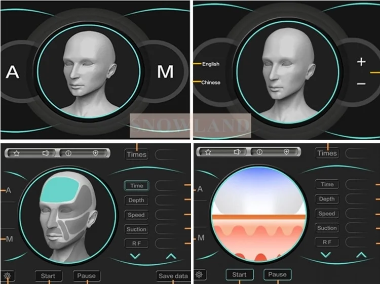 Fractional Rf Microneedle Machine/factory price of Rf Fractional machine
