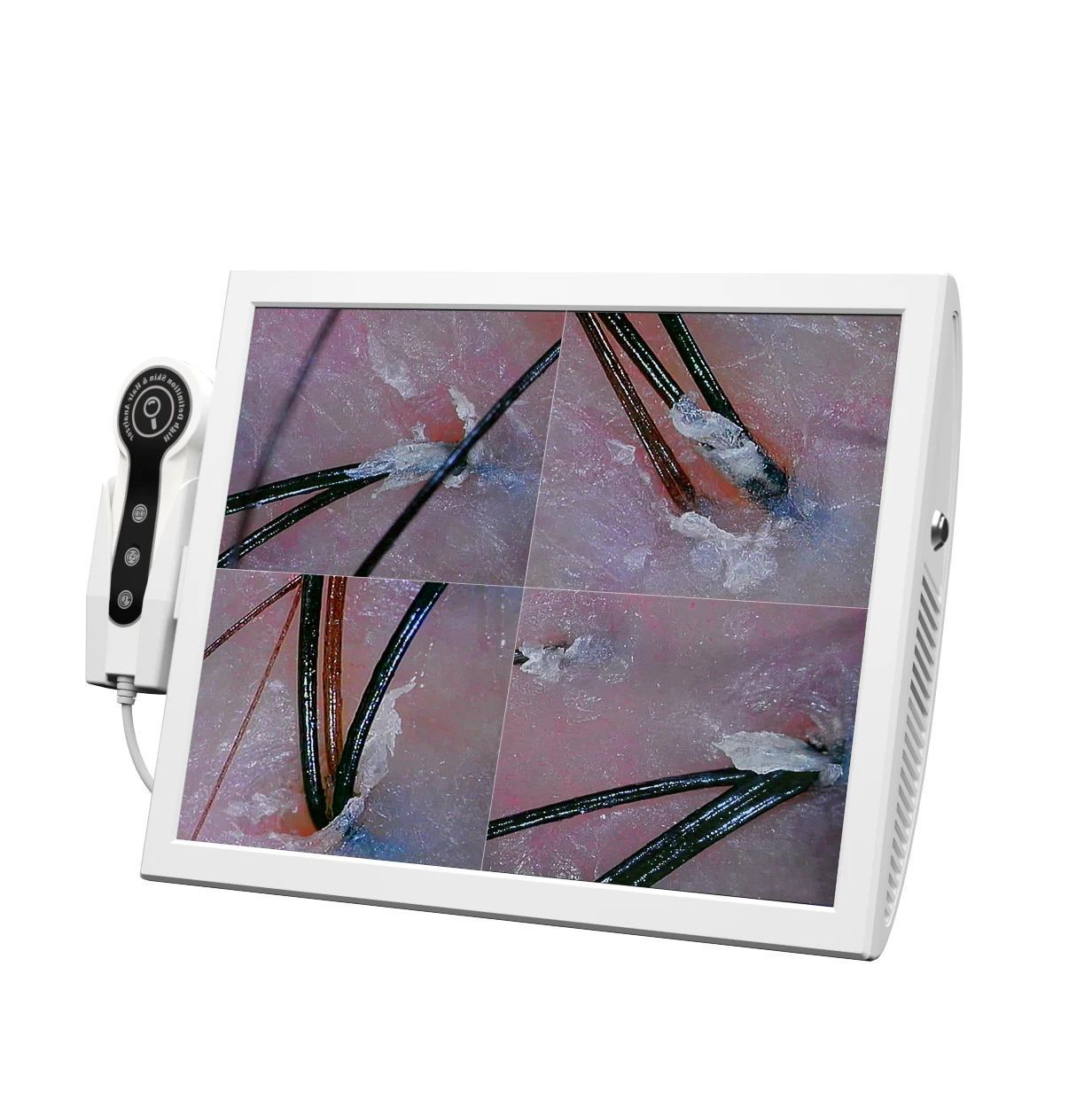 Professional Scalp Care Hair Follicle Detector Scalp Analysis Machine / Skin And Hair Analyzer