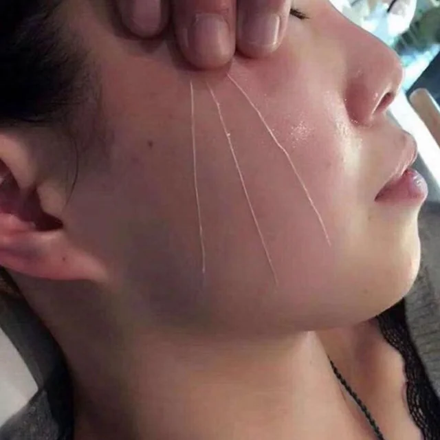 Safe and effective No Needle Facial Collagen Thread Lift Gold Protein Peptide Line Carving For Anti-wrinkle