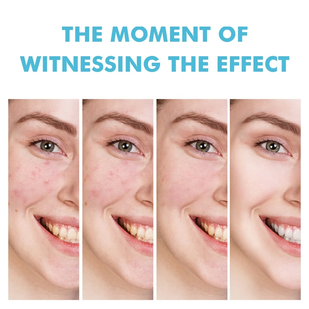 Fast Effective Repair Pimple Scar Anti Spots Removal Acne Gel Smooth Skin Shrink Pores Salicylic Acid Acne Treatment Cream