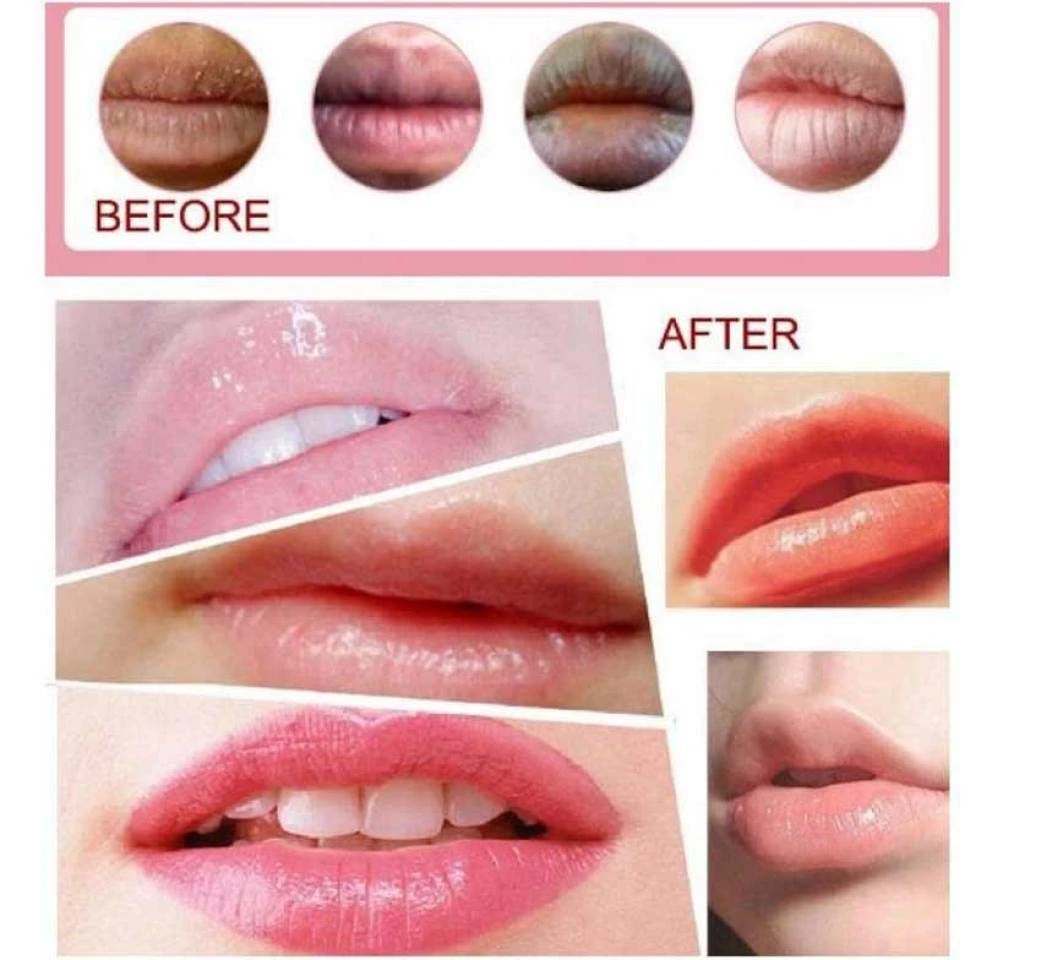 Private Label Cruelty Free Vegan Soft Collagen Whitening Bleaching Treatment Pink Lip Lightening Cream For Dark Lips