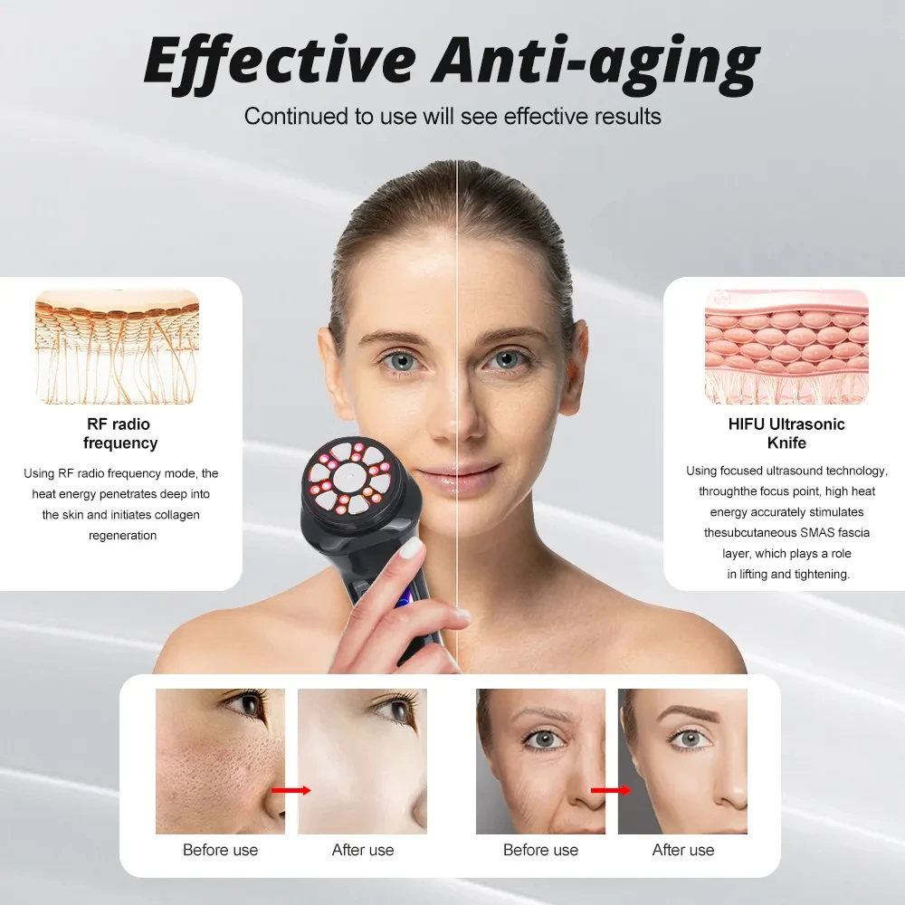 Manufacturer Wholesale 4 In 1 Beauti Facial Home Beauty Photorejuvenation Device Face Lifting Machine  Rf Face Massager