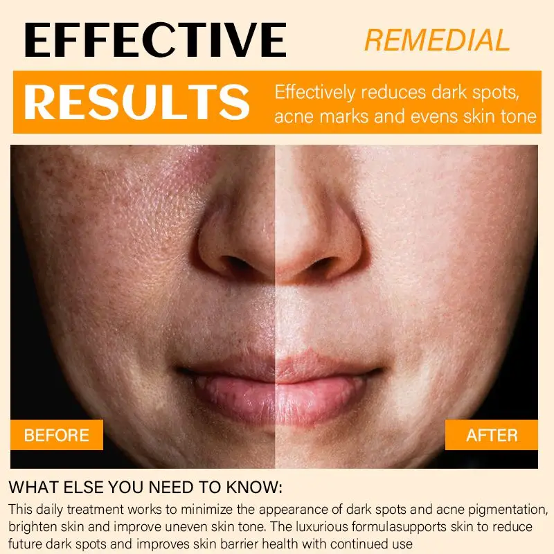 OEM facial skin care dark spots removal moisturizing anti aging arbutin beauty face cream whitening freckle