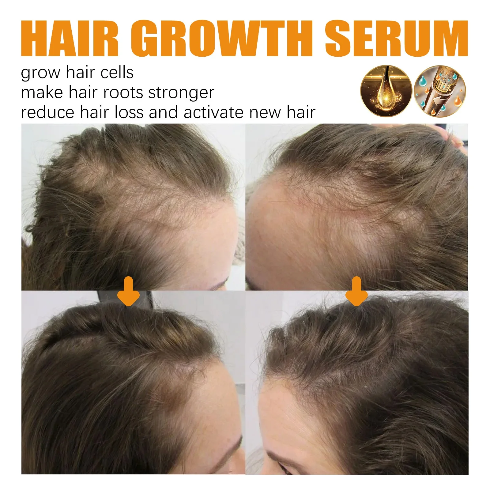 Private Label Biotin Hair Growth Serum Plant Extract Boost Hair Growth Prevent Loss Castor Oil Hair Growth Spray