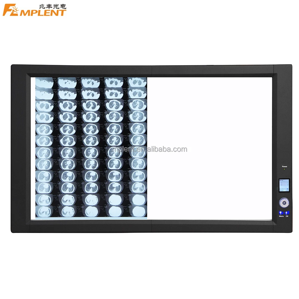Mplent Ultra Bright LED Negatoscope X-ray film viewer medical equipment for hospital