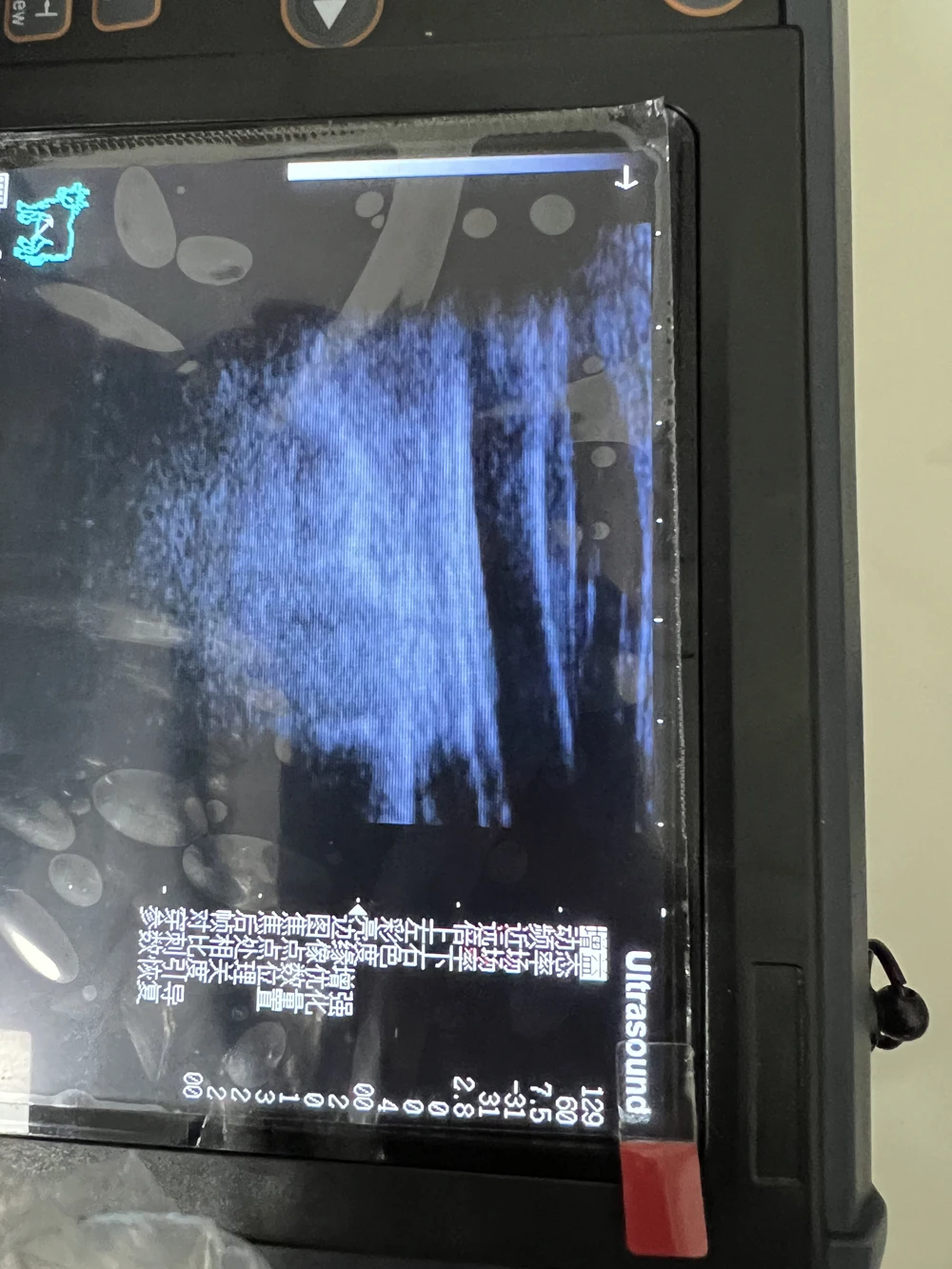S1 vet ultrasound 01.jpg