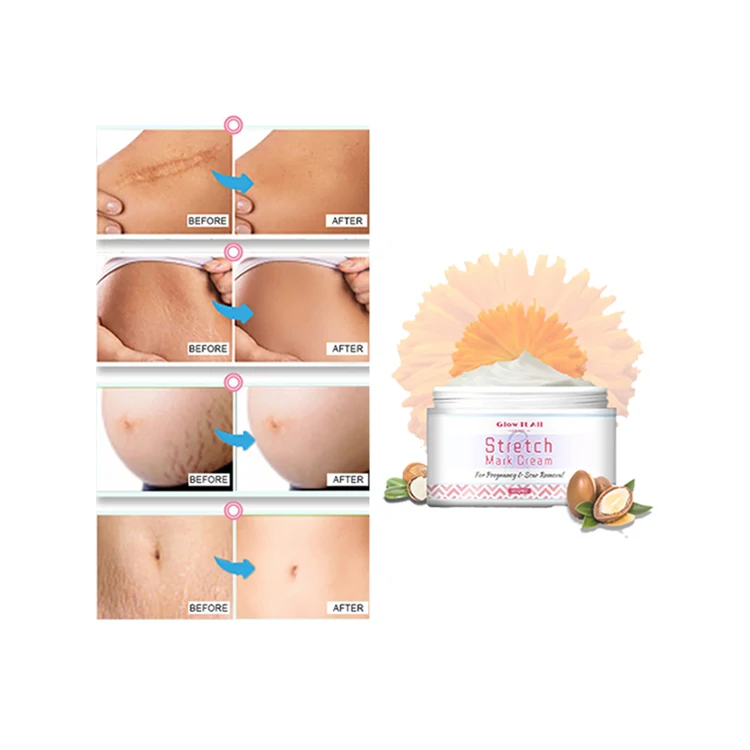 
 Cantik все естественные растяжек крем масло семян ши крем мощный Осветляющий против растяжек крем для удаления  