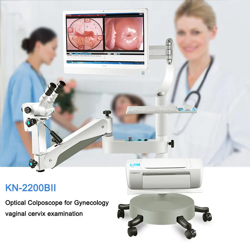 Kernel KN-2200BII Optical Vaginal Colposcopy Machine Medical Device Gynaecology Video Optical Colposcope for Gynecology