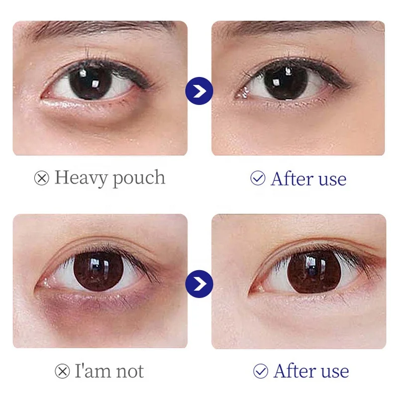 Wholesale Collagen Firming Anti Wrinkle Puffiness Repairing Dark Circle Tightening Bags Removal Under Eye Cream