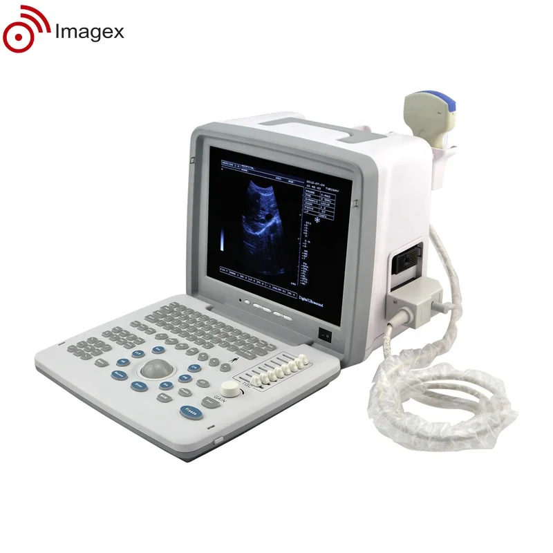 Factory Price Medical Ultrasound Scanner for Obstetric and Gynecological Use