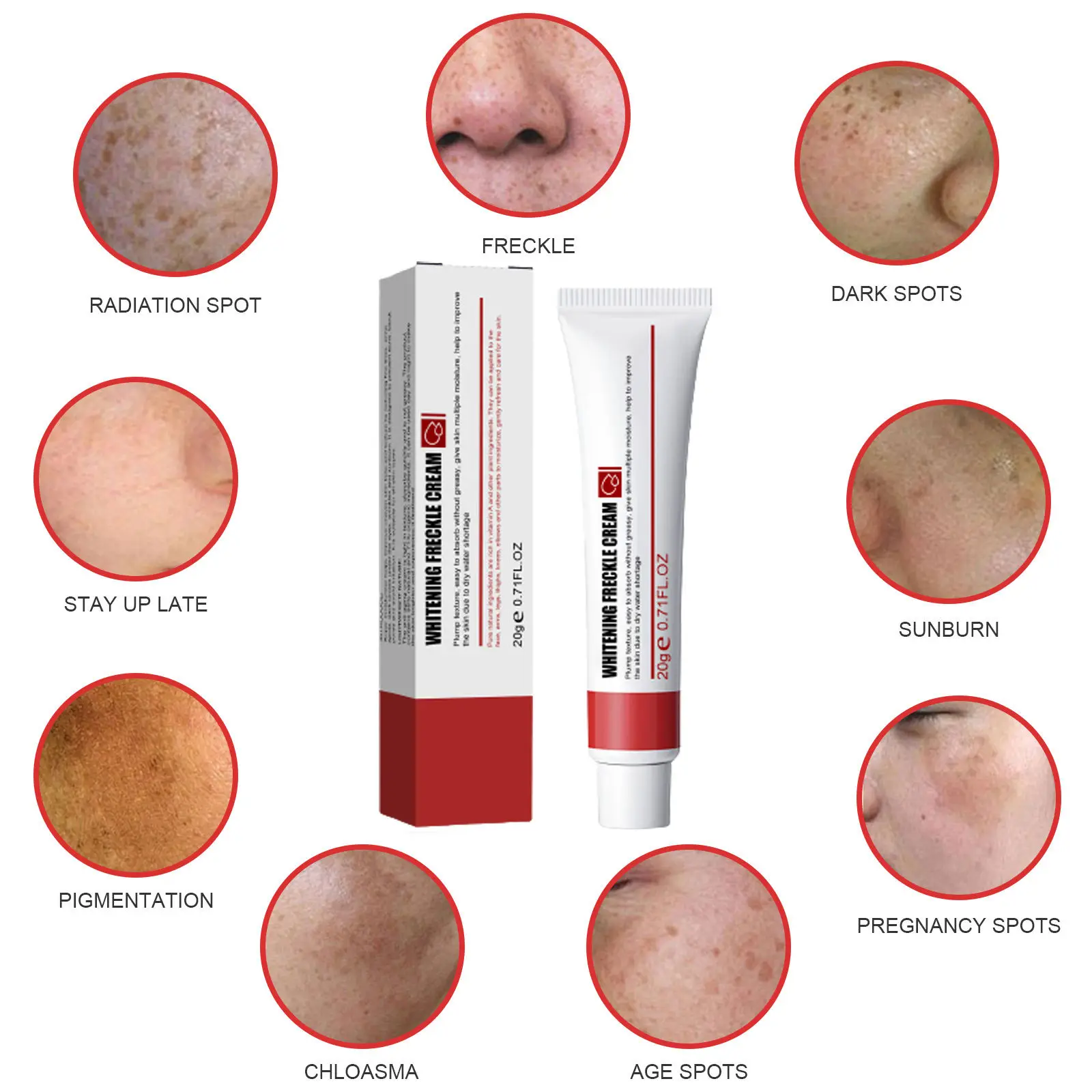 Private Label Freckles Removal Whitening Face Dark Spot Remover Corrector Cream