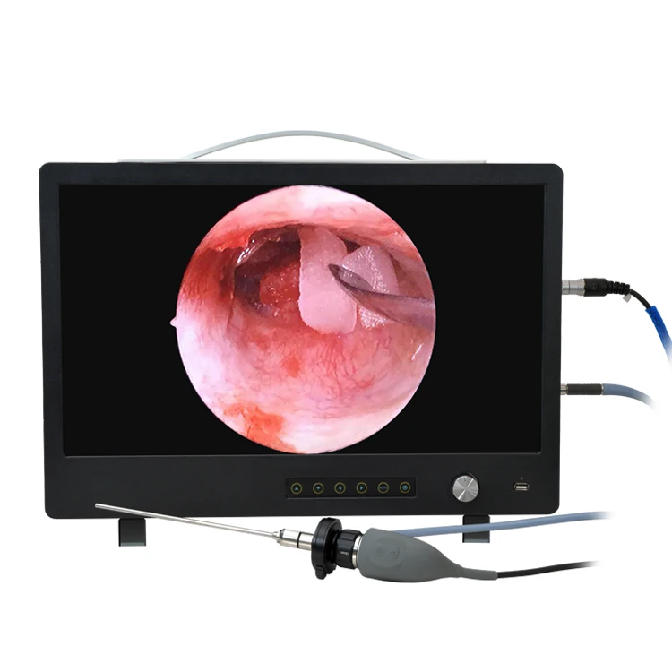 Portable 22 inch Full HD 1080P Endoscopic Camera with recording function