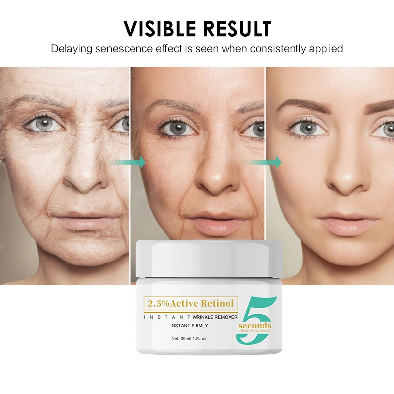 OEM Private Label Retinol Face Cream With AHA 30% BHA2% Anti Aging Anti Fine Lines Wrinkle Facial Cream Skincare Products