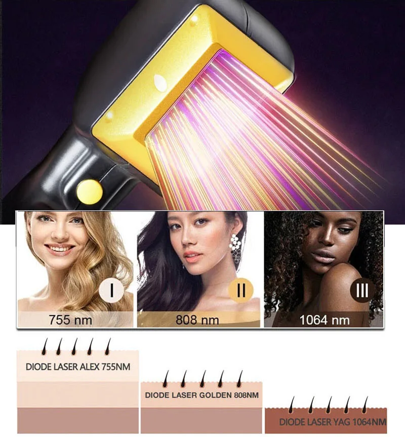 3 waves 755nm 808nm 1064nm diode laser ice titanium platinum laser 810/Hair removal 755nm alexandrite laser hair removal