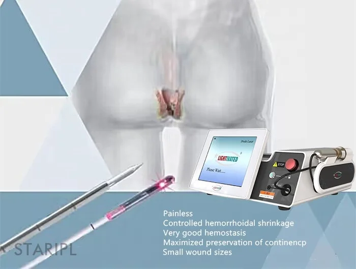 Medical Hemorrhoids Laser Machine 980nm 1470nm Diode Laser Germany Urology Laser Fistula Surgery Device Rectal Proctology