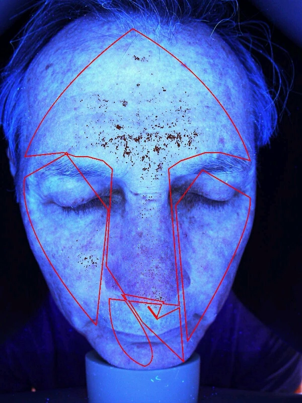 Best skin analyzer digital skin analyzer with skin analysis camera