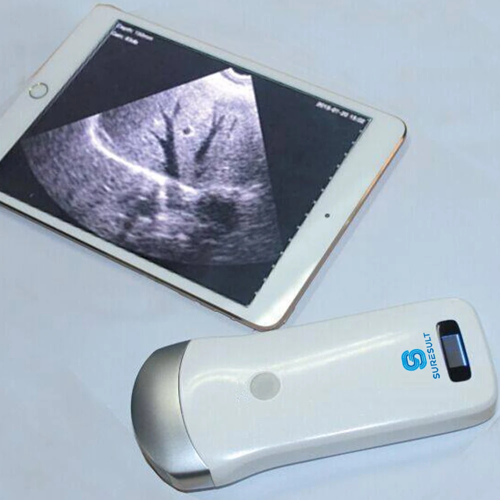 Suresult 80 Elements 3.5 MHz Convex Ultrasound 5GWifi Wireless Ultrasound Probe medical ultrasound instruments