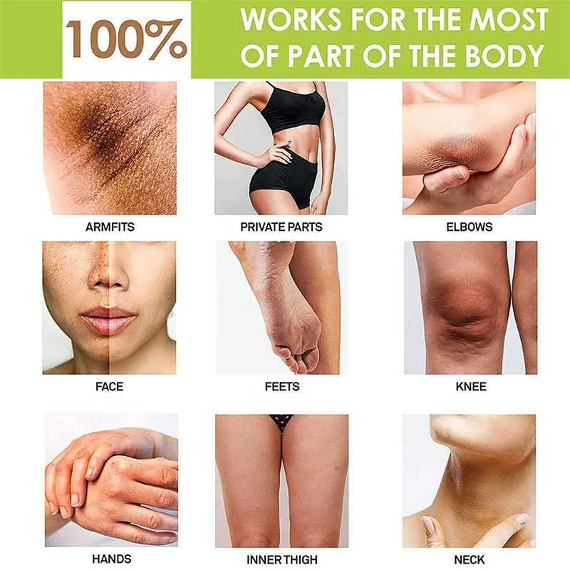 Urea 40% & Salicylic Acid 2% Intensive Moisturizing Cream Hand Foot Callus Remover Soften Exfoliate Dead Skin For Dark Elbows