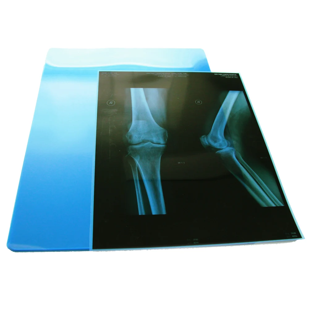
Wholesale medical dry x-ray film fujifilm DI-HL dry laser imaging film 