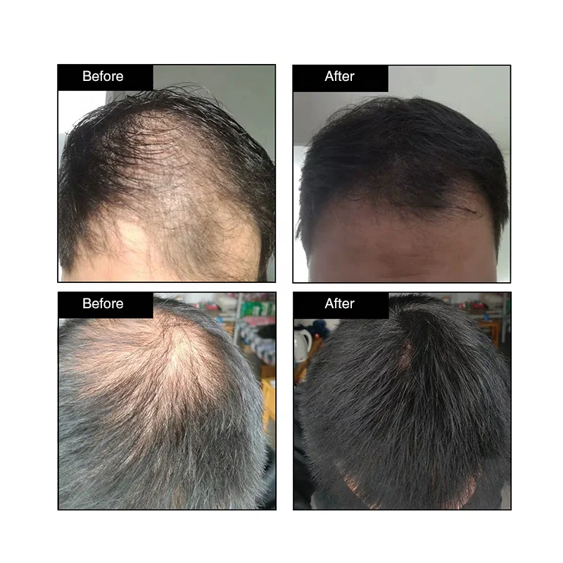 
Instantly Thickening Hair Building Fibers For Hair Loss treatment factory price 