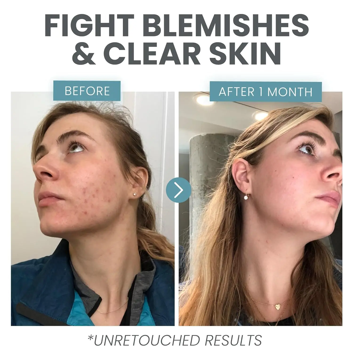 OEM Skin Clearing Brightening Acne Anti Aging Salicylic Acid Dark Spot Treatment Vitamin C Serum