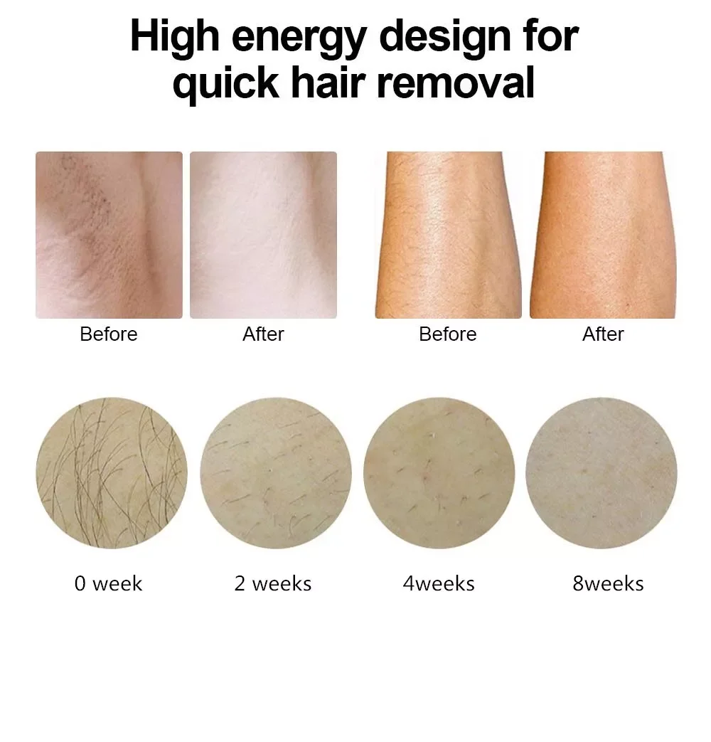 ICE IPL permanent hair removal 2 in1 skin rejuvenation device home use IPL Laser hair removal machine