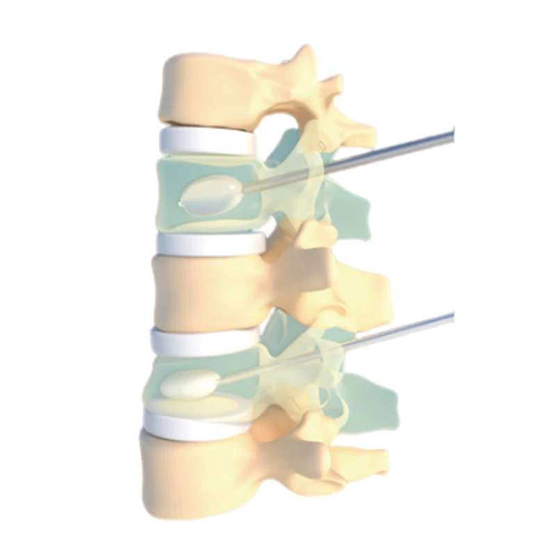 Factory Direct Sales Of High-Quality Hot-Selling Medical Dilators With Guide Needles