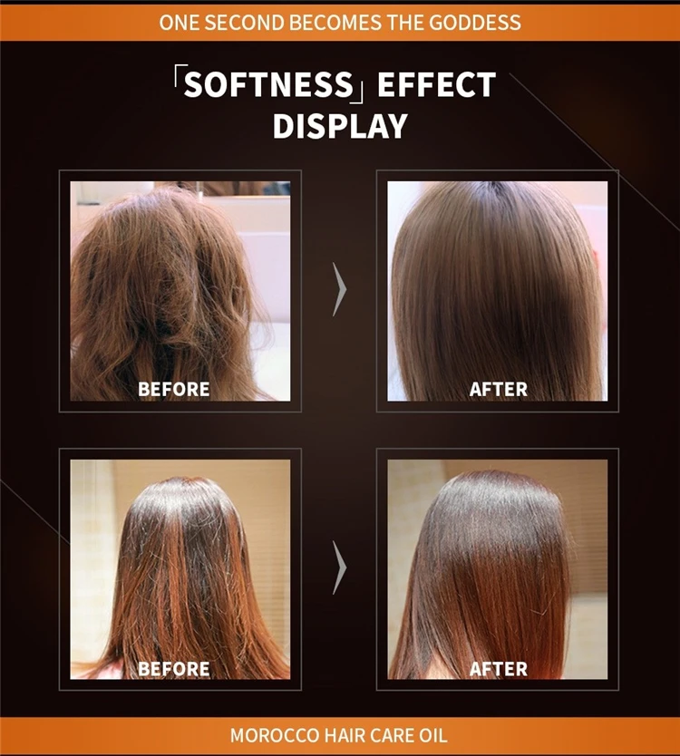 Wholesale Best Hair Building Fiber Spray Natural Cure Hair Loss Product For Bald Head