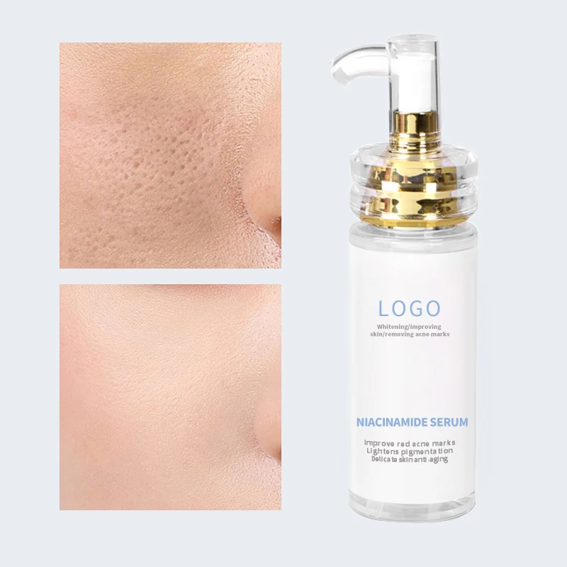 OEM Pure Natural Syclic Age Diamond Oil Control Vitamin C Hyaluronic Acid Retinol Whitening Ordinary Niacinamide Serum For Face