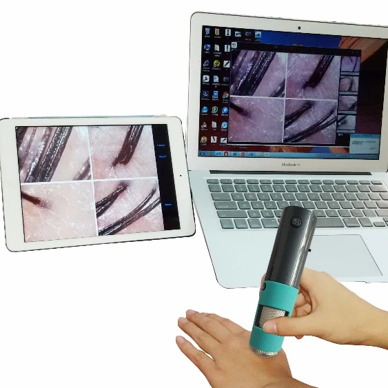 Wifi wireless Portable Hair Scalp Detector Hair Care Tool Profession skin hair scalp detector manufacturer