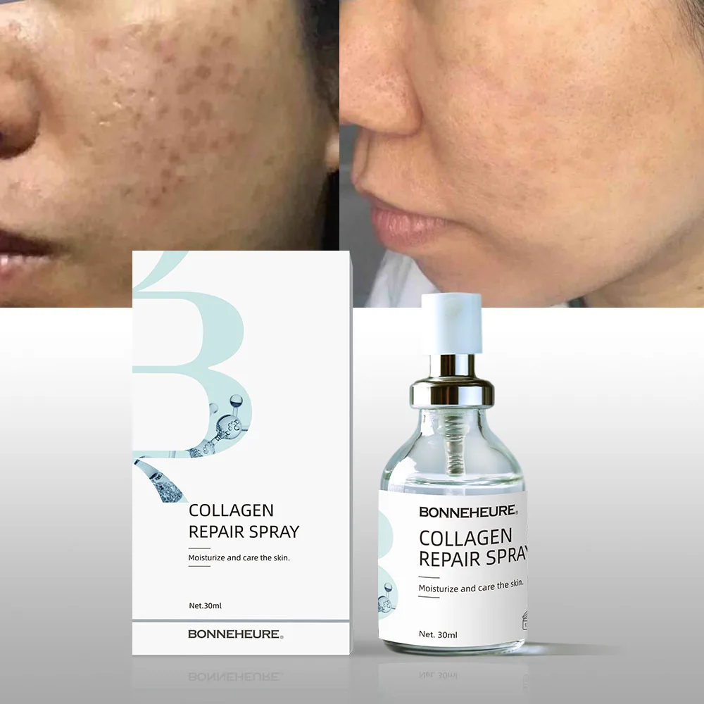 Natural Whitening Toning Lotion Wound Care Products Wound Dressing Spray Active Skin Repair Dressing Spray