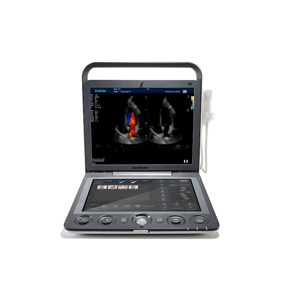 factory price Sonoscape S9 / S9pro 3D 4D Portable Color Doppler ultrasound machine