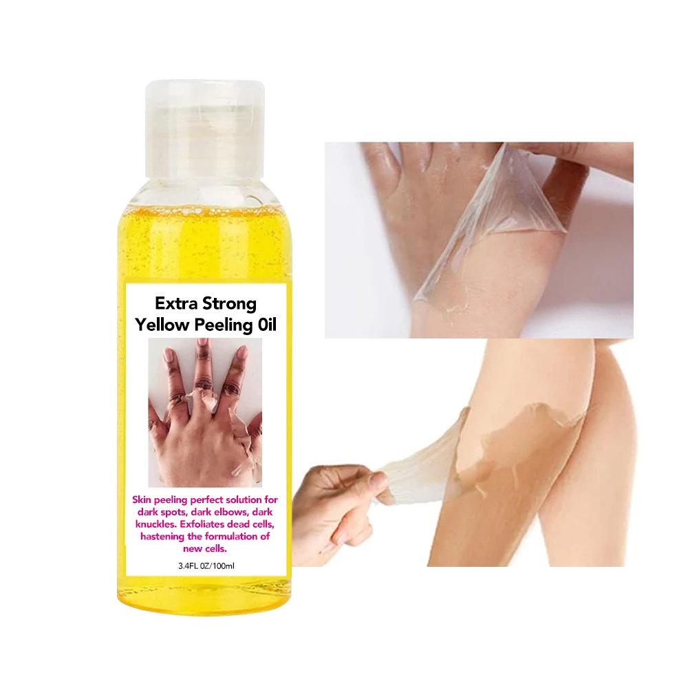 Organic Peel Therapy Extra Strong Yellow Peeling Oil Foot Extra Strong Peeling Oil