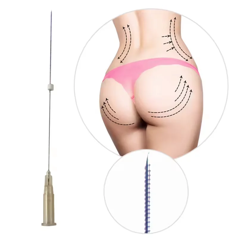 High Quality Tornado Screw Thread CE Approved 26 27G Screw Thread PDO PCL PLLA Thread For buttock lift