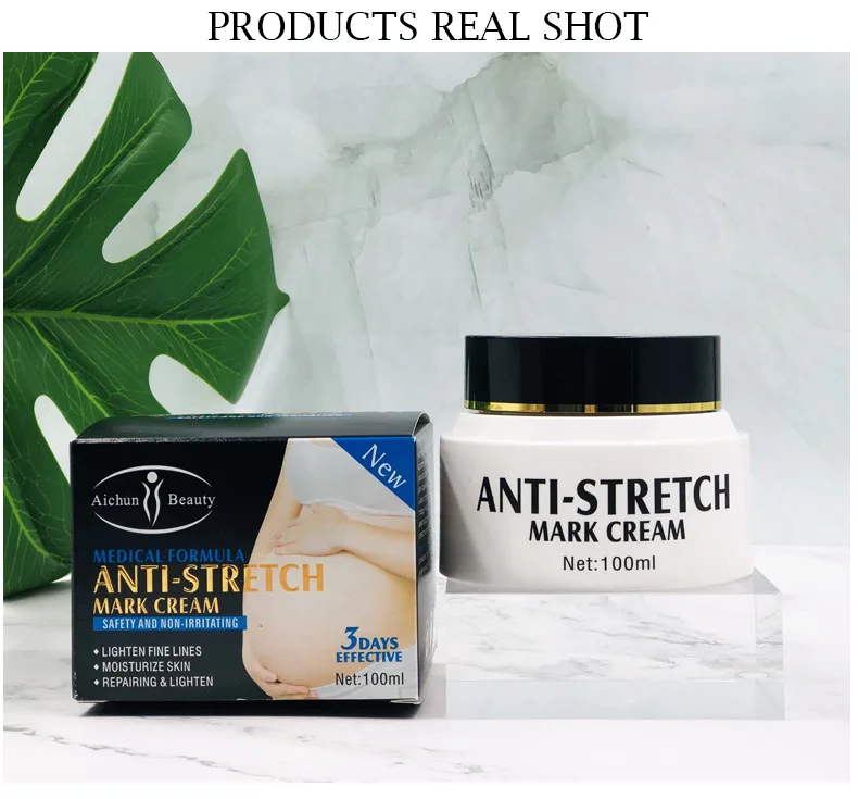 Hot Selling Remove Scars Acne Natural Lightening Anti Stretch Mark Cream For