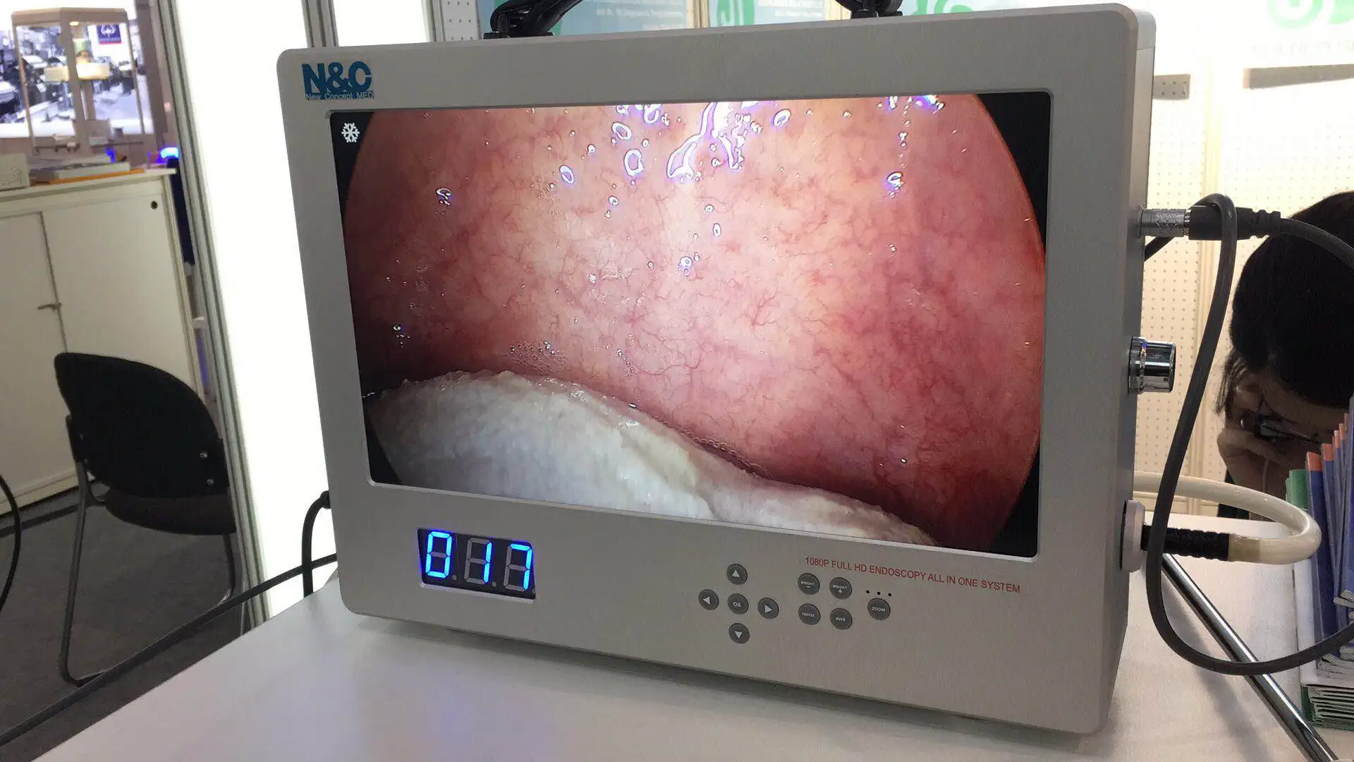 Portable ENT/Laparoscopy/Urology Medical Endoscopy Camera USB Full HD 1080P 4K